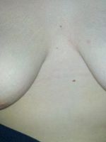 Photo 10, First huge knockers